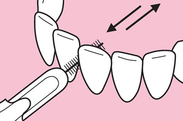 Interdentalbürsten Nutzung Interdentalbürsten Nutzung