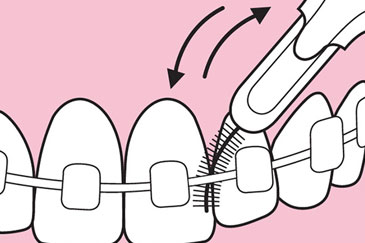 Interdentalbürsten Nutzung Interdentalbürsten Nutzung