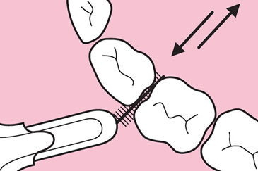 Interdentalbürsten Nutzung Interdentalbürsten Nutzung